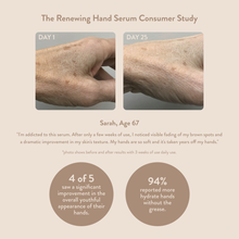 Load image into Gallery viewer, Renewing Hand Serum For Aging Skin | #1 Best Seller